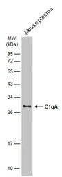 Anti-C1qA antibody used in Western Blot (WB). GTX134007