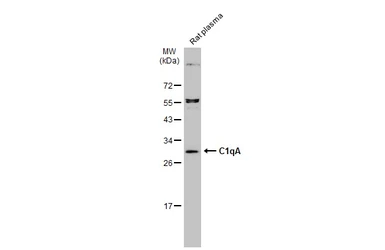 Anti-C1qA antibody used in Western Blot (WB). GTX134007