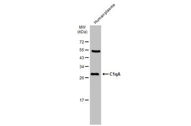 Anti-C1qA antibody used in Western Blot (WB). GTX134007