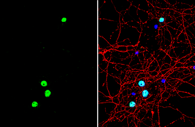 Anti-FOXG1 antibody used in Immunocytochemistry/ Immunofluorescence (ICC/IF). GTX134018
