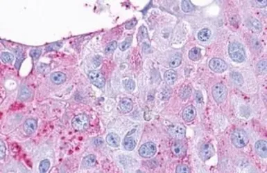 Anti-TA3 antibody used in IHC (Paraffin sections) (IHC-P). GTX13402