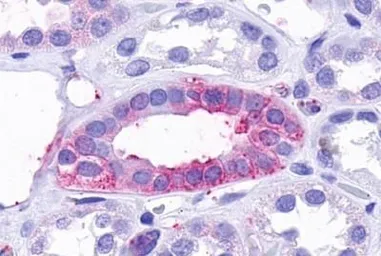 Anti-TA3 antibody used in IHC (Paraffin sections) (IHC-P). GTX13402