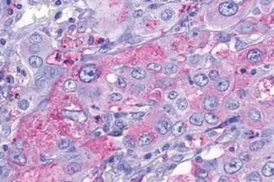 Anti-TA3 antibody used in IHC (Paraffin sections) (IHC-P). GTX13402