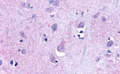 Anti-TA3 antibody used in IHC (Paraffin sections) (IHC-P). GTX13402