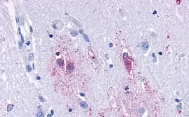 Anti-TA3 antibody used in IHC (Paraffin sections) (IHC-P). GTX13402