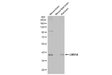 Anti-LMX1A antibody used in Western Blot (WB). GTX134047