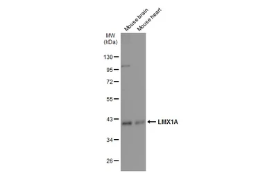 Anti-LMX1A antibody used in Western Blot (WB). GTX134047