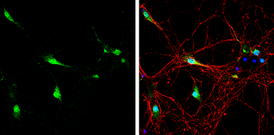 Anti-Neurogranin antibody used in Immunocytochemistry/ Immunofluorescence (ICC/IF). GTX134048