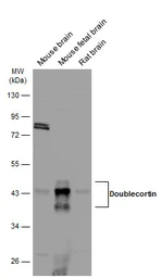 Anti-Doublecortin antibody used in Western Blot (WB). GTX134052