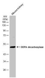 Anti-DOPA Decarboxylase antibody used in Western Blot (WB). GTX134053