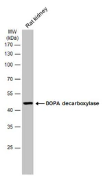 Anti-DOPA Decarboxylase antibody used in Western Blot (WB). GTX134053