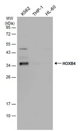 Anti-HOXB4 antibody used in Western Blot (WB). GTX134055
