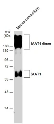 Anti-EAAT1 antibody used in Western Blot (WB). GTX134060