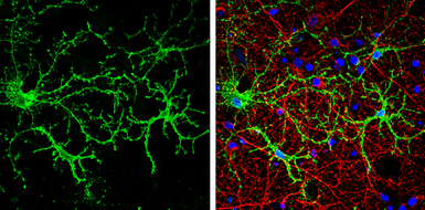 Anti-EAAT1 antibody used in Immunocytochemistry/ Immunofluorescence (ICC/IF). GTX134060