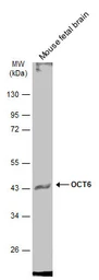 Anti-OCT6 antibody used in Western Blot (WB). GTX134063