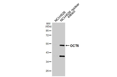 Anti-OCT6 antibody used in Western Blot (WB). GTX134063