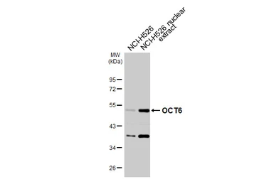 Anti-OCT6 antibody used in Western Blot (WB). GTX134063