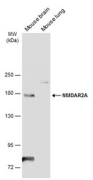 Anti-NMDAR2A antibody used in Western Blot (WB). GTX134064