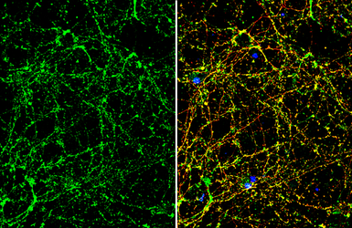 Anti-NMDAR2A antibody used in Immunocytochemistry/ Immunofluorescence (ICC/IF). GTX134064