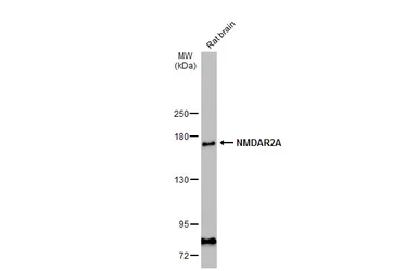 Anti-NMDAR2A antibody used in Western Blot (WB). GTX134064