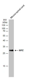Anti-MPZ antibody used in Western Blot (WB). GTX134070