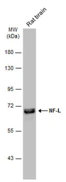 Anti-NF-L antibody used in Western Blot (WB). GTX134075