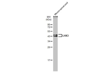 Anti-LHX3 antibody used in Western Blot (WB). GTX134076