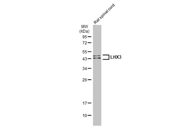 Anti-LHX3 antibody used in Western Blot (WB). GTX134076