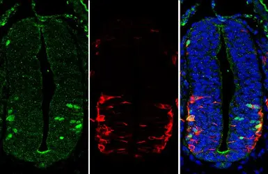 Anti-LHX3 antibody used in IHC (Paraffin sections) (IHC-P). GTX134076