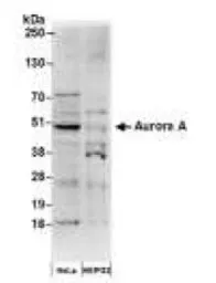 Anti-Aurora A antibody used in Western Blot (WB). GTX13408