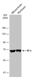 Anti-NF-L antibody used in Western Blot (WB). GTX134085