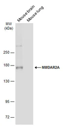Anti-NMDAR2A antibody used in Western Blot (WB). GTX134086