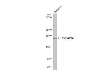Anti-NMDAR2A antibody used in Western Blot (WB). GTX134086