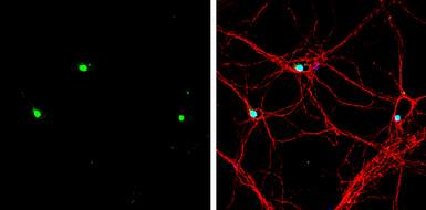 Anti-TBR2 / Eomes antibody used in Immunocytochemistry/ Immunofluorescence (ICC/IF). GTX134088