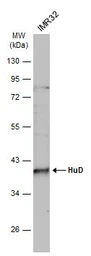 Anti-HuD antibody used in Western Blot (WB). GTX134099