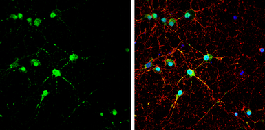 Anti-EAAT4 antibody used in Immunocytochemistry/ Immunofluorescence (ICC/IF). GTX134100