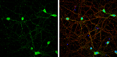 Anti-vGluT3 antibody used in Immunocytochemistry/ Immunofluorescence (ICC/IF). GTX134103