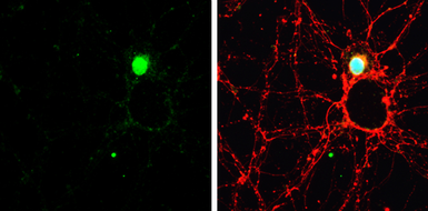 Anti-SATB2 antibody used in Immunocytochemistry/ Immunofluorescence (ICC/IF). GTX134105