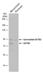 Anti-SATB2 antibody used in Western Blot (WB). GTX134105