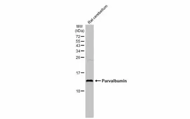 Anti-Parvalbumin antibody used in Western Blot (WB). GTX134110
