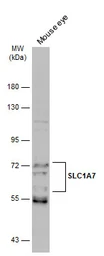 Anti-SLC1A7 antibody used in Western Blot (WB). GTX134113