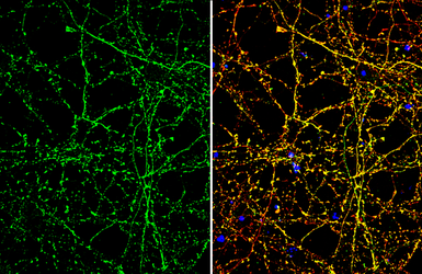 Anti-SLC1A7 antibody used in Immunocytochemistry/ Immunofluorescence (ICC/IF). GTX134113