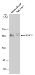 Anti-ROBO2 antibody used in Western Blot (WB). GTX134119
