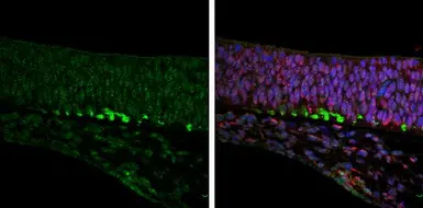 Anti-ROBO2 antibody used in IHC (Paraffin sections) (IHC-P). GTX134119