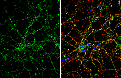 Anti-ROBO2 antibody used in Immunocytochemistry/ Immunofluorescence (ICC/IF). GTX134119
