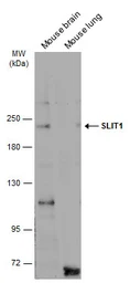 Anti-SLIT1 antibody used in Western Blot (WB). GTX134122