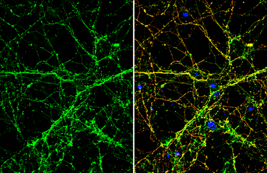 Anti-SLIT1 antibody used in Immunocytochemistry/ Immunofluorescence (ICC/IF). GTX134122