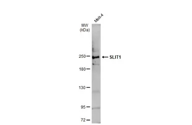 Anti-SLIT1 antibody used in Western Blot (WB). GTX134122