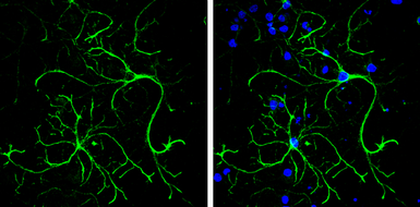 Anti-Desmuslin antibody used in Immunocytochemistry/ Immunofluorescence (ICC/IF). GTX134124