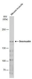 Anti-Desmuslin antibody used in Western Blot (WB). GTX134124